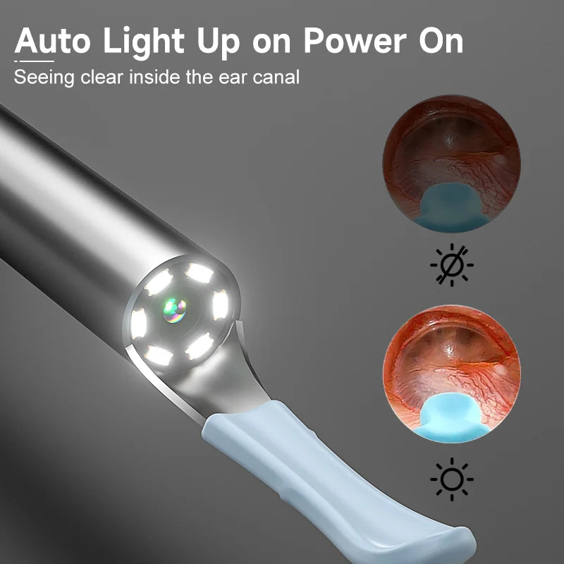 Smart Visual Ear Camera WIFI Ear Pick Waterproof Ear Cleaner Endoscope Digital Ear Wax Removal Tool Ear Spoon Case