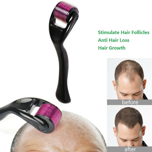 Hair growth tool with before and after images of hair loss treatment on a white background