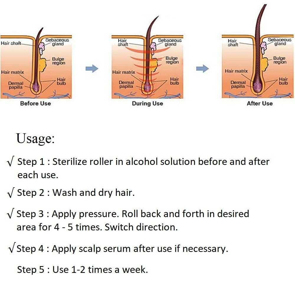 Illustration showing the use of a scalp treatment roller with steps for sterilization, washing, applying pressure, and usage frequency.